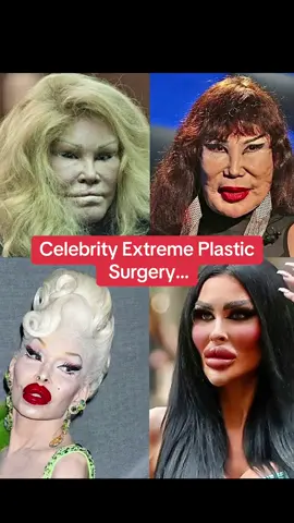 Like for Pt.2😱😳! #celebrity #actor #actress #fy #fyp #xyzbca #foryoupage #surgery 