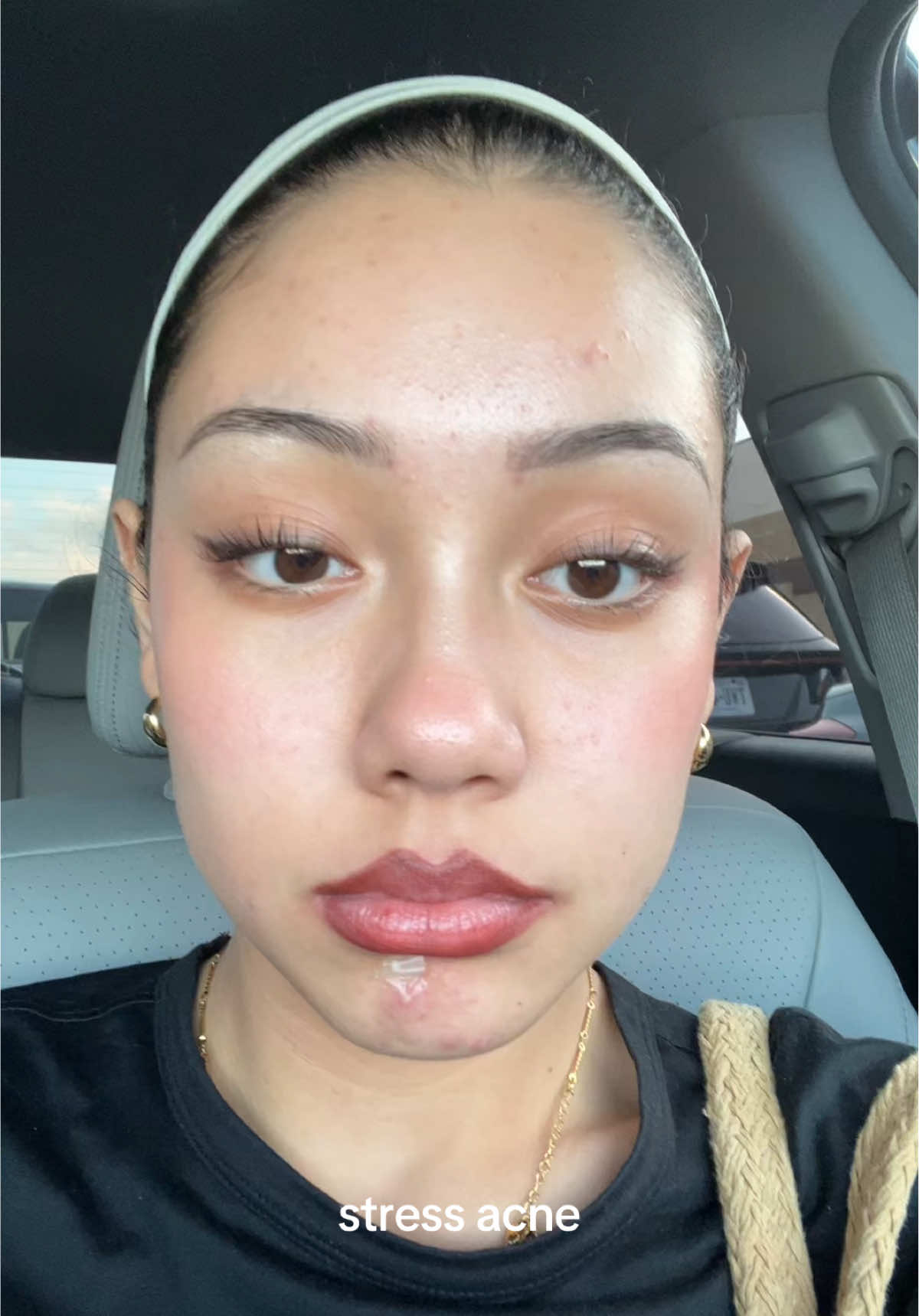 i don’t post as much cause for the past few months my skin has been looking very icky
