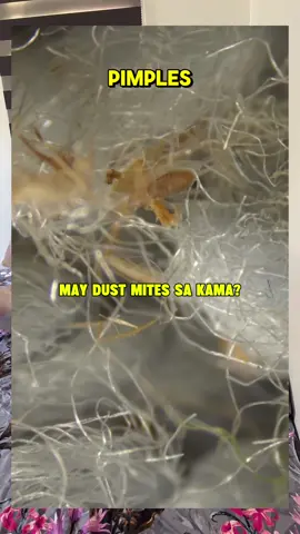 Baka marumi higaan mo. Bilis magcheck 0ut kana ng MOVA D20 Dust Mite Remover  #dustmiteremover #MOVA #MOVAPH #MOVAD20 #MOVADUSTMITEVACUUM @Mova official(S&R ROADSHOW) 