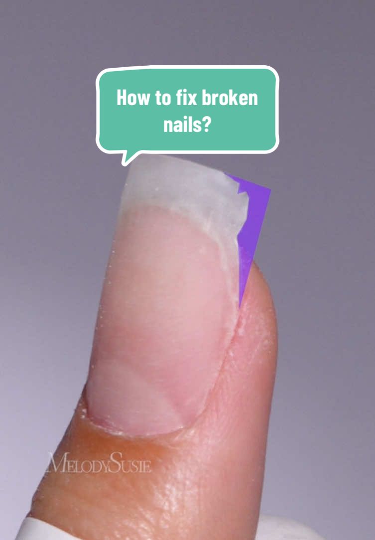 How to fix broken nails? Use dual form and builder gel to fix it! Quick cure gel using P-Plus 20F Nail Lamp! #TikTokShopMemorialDay #melodysusie #melodysusienails #nailtools #nailart #nailchallenge #nailtutorial #nailtechlife #nailtechcheck #nailtechproblems #nailtechnician #nails #nailbeginner #nailpro #naillover #nailhack #nailtips #nailtip #naillamp #nailtok #nailgel #nailsoftiktok 