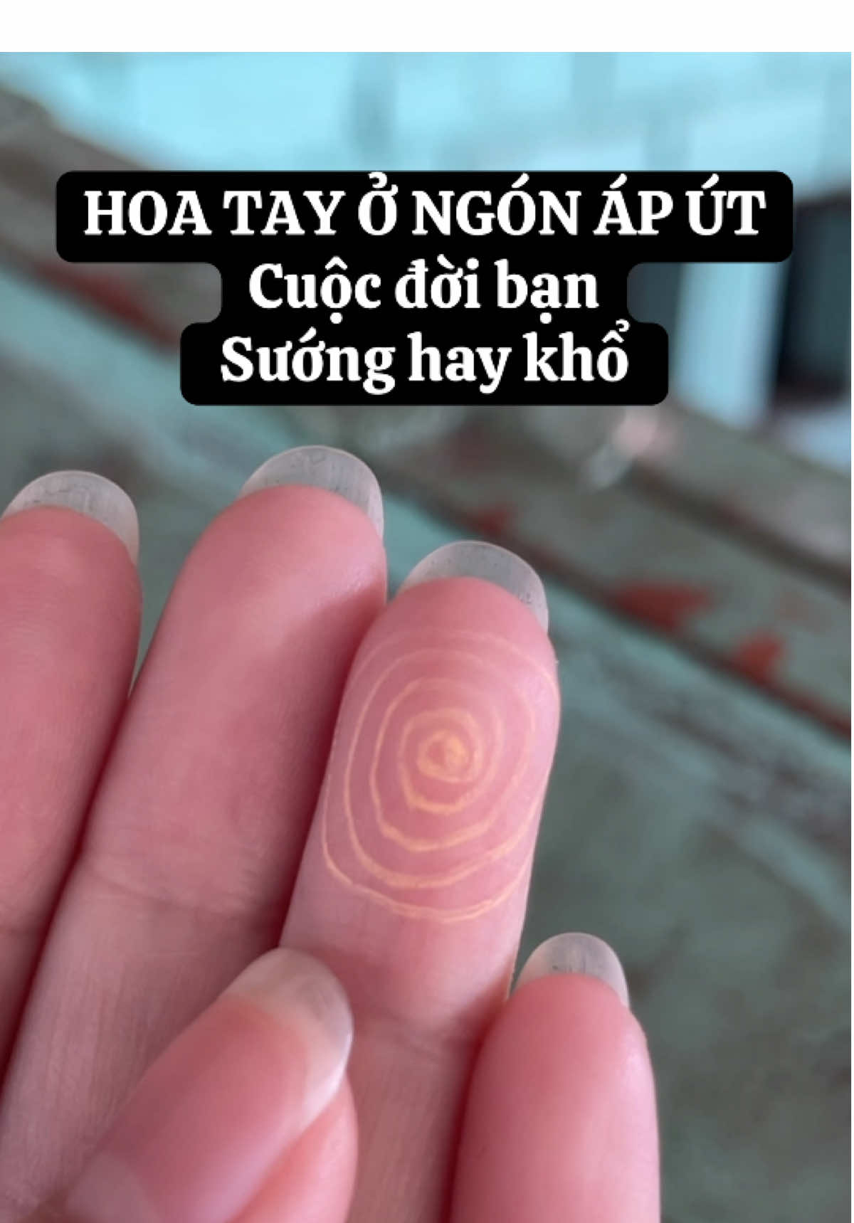 BẠN CÓ DẤU HIỆU NÀY KHÔNG? NHẮN NGAY CHO TÔI NHÉ #VậnMệnhRadio #TuongSo #vanmenhradio #VậnMệnh #LuậnChỉTay #PhúcTướng #xemchitay #xemchitaymienphi #xemboi 