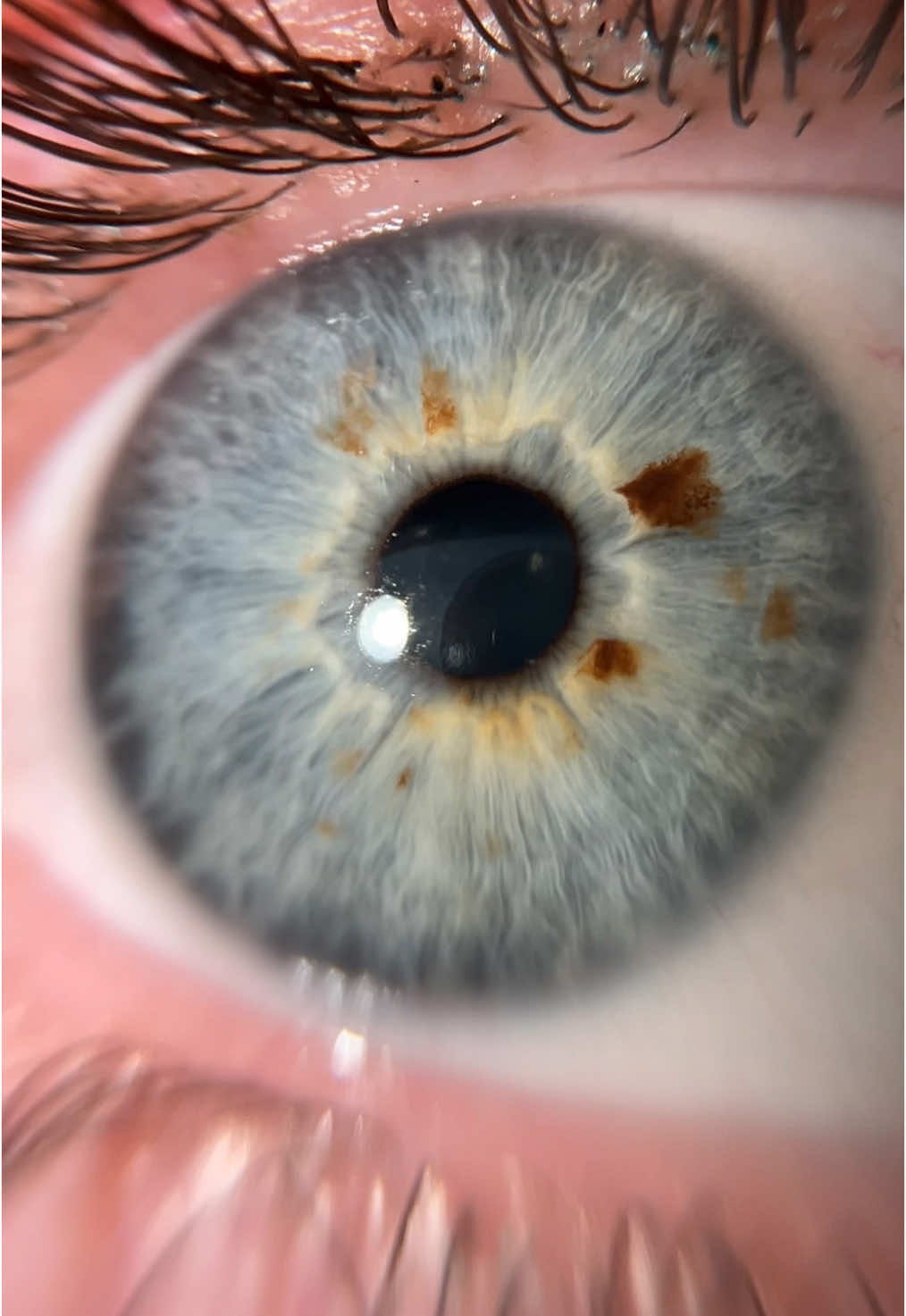 Have you ever seen freckles in a eye? 🍂🦋  #eyetrend #viral #eyes #blueeyes #grayeyes #greyeyes #prettyeyes 