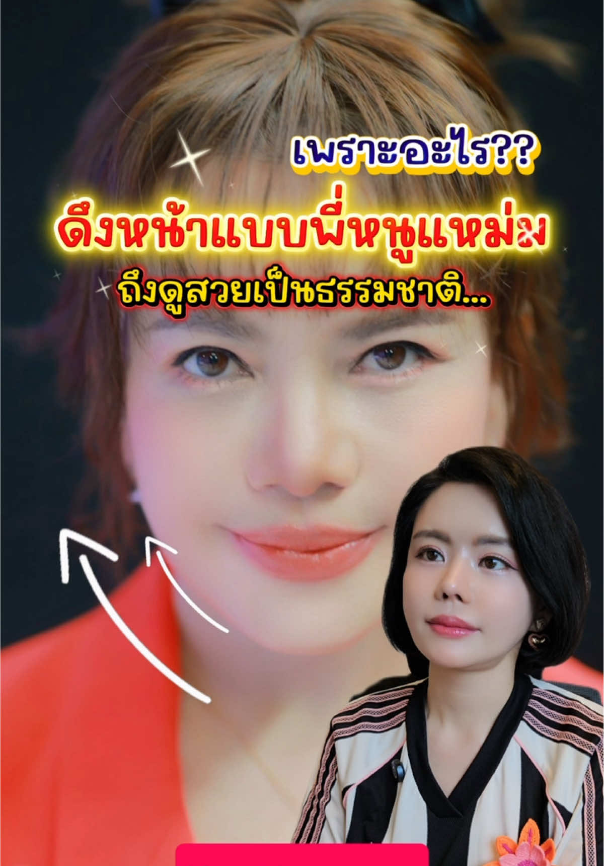 เพราะอะไร ดึงหน้าแบบพี่หนูแหม่มถึงสวยและดูเป็นธรรมชาติ✨ ❤ติดต่อหรือจองคิว👇 Line ID : @AeySurgery(มี@ค่ะ) #Aeysurgery #ศัลยกรรม #ศัลยกรรมเกาหลี #รีวิวศัลยกรรม #รีวิวศัลยกรรมเกาหลี #ศัลยกรรมความงาม #ศัลยกรรมที่ไหนดี #koreasurgery #nanahospital