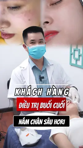 Trị liệu Nám Chân Sâu Hori buổi cuối cùng - chia tay bs 😍😍😍#xuhuong #nám #nám_chân_sâu #hori #giãn_mao_mạch #làm_đẹp #nám_má #drhainguyen #tàn_nhang #bshainguyen 