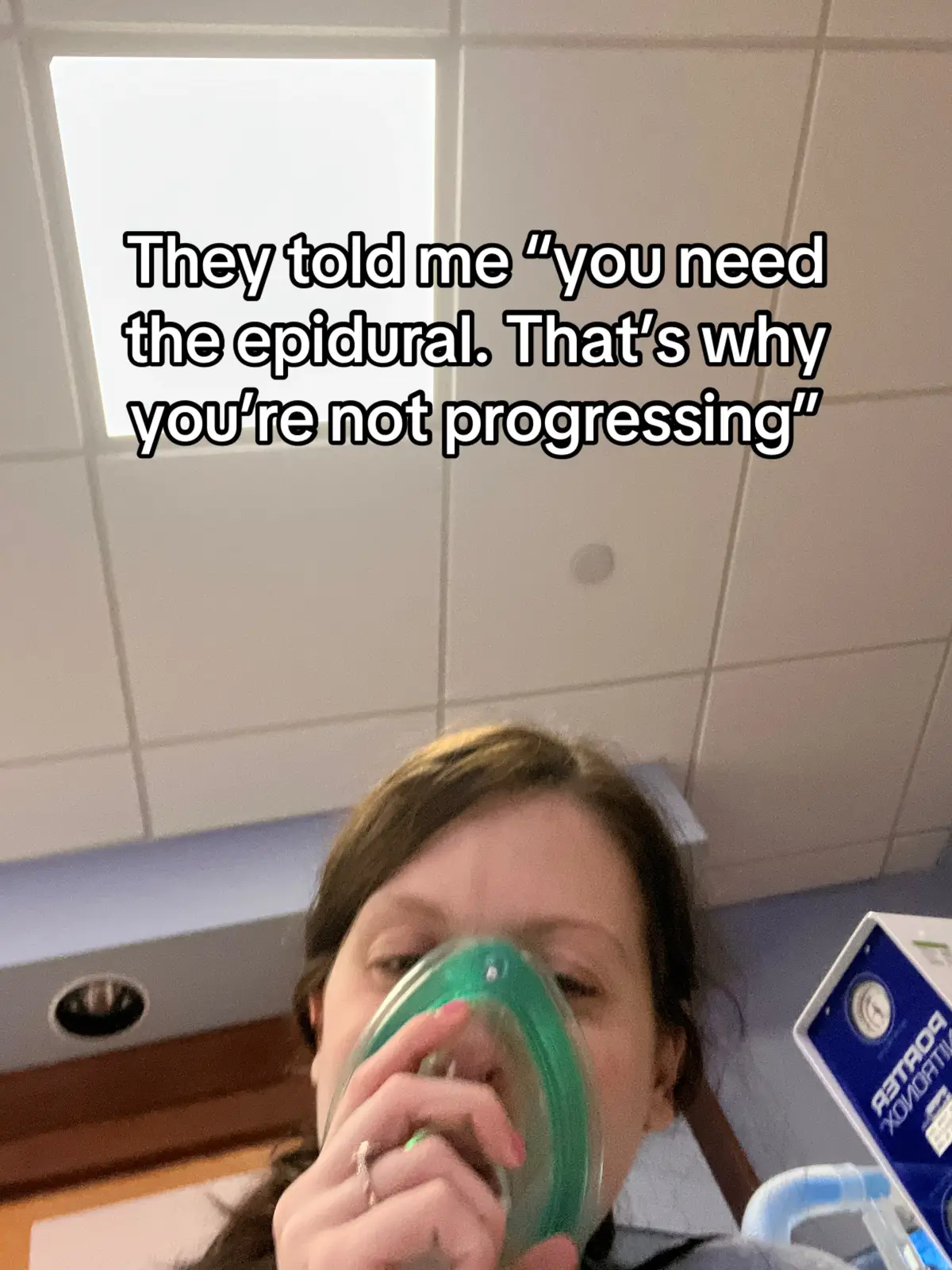 It was everyone’s first time seeing a birth like that (doctor included) and while it was absolutely amazing, I have never experienced the ring of fire in such a way 😵 #encaulbirth #holyfknairball😝😝 #epidural #fyp #laboranddelivery #stillbornawarness 