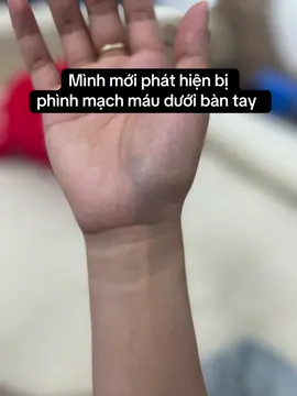 Vẫn chưa giám nói. Đau mà tự chịu 😢😢
