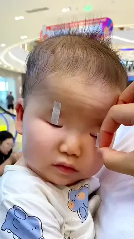 Taping Chines Baby Eye #viral #foruyou #unfreezemyacount #grownmyaccount 