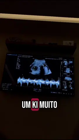 Já sentimos o ki dele 💪🔥 #supersaiajin  #dragonballz 