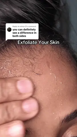 Replying to @mina<3 Trying Dr. Melaxin Peel Shot with a freshly washed face ✅ #exfoliate #skincareroutine #skincare 