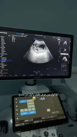 #حمل #ماشاءاللّٰه #الرياض❤️ 