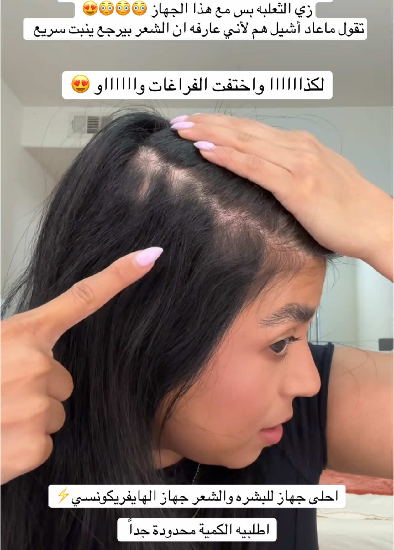 #اكسبلور #اكسبلورر #عناية #العناية_بالبشرة #بشرة_دهنية #حبوب_الوجه #هايفريكونسي #هاي_فريكونس #تنبيت_الشعر #تكثيف_الشعر #تطويل_الشعر 