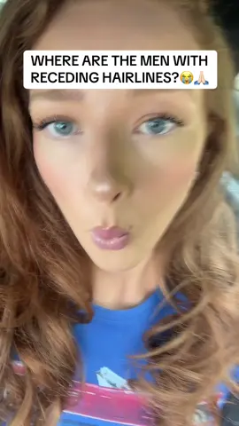 WHERE THEY AT DOE #fyp #bald #baldmen #recedinghairline #wheretheyattho 