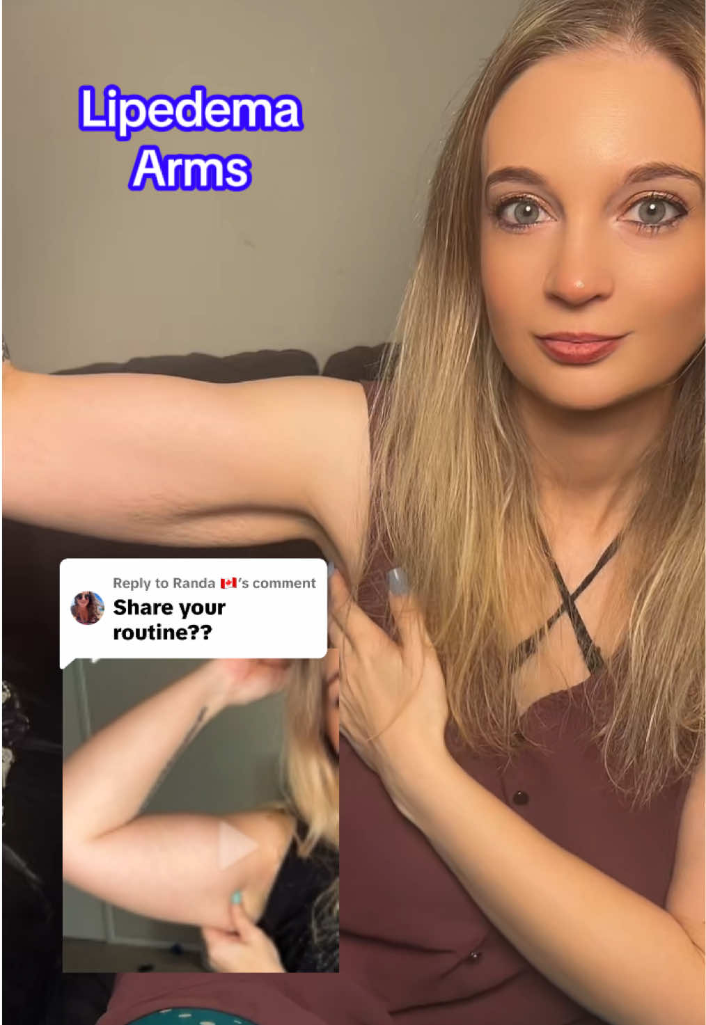 Replying to @Randa 🇨🇦 here’s my routine been doing for my Lipedema arms. #lipedema #lipedemaarms #lipedemafighter #fibrosis #arms 