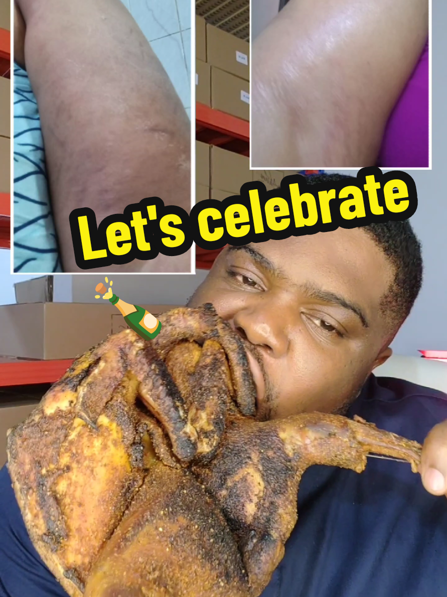 Watsapp us on +233547499344 to place your Order and grab the trending Ahum Stretch mark oil and balm #stretchmarks #tiktokghana🇬🇭 #tiktoknigeria🇳🇬 #stretchmarkremoval #stretchmarksremedy #stretchmarksolution #stretchmarksremedy #fyp #fypp #recommendations #skincarerecommendations #skincare #skincareroutine #goviral  #ahumstretchmarksoil #ahumstretchmarkoil #ahumstretchmarkbalm #ahumskincare  #tiktokuganda🇺🇬🇺🇬🇺🇬 #tiktokkenya🇰🇪 #tiktoktanzania🇹🇿 #tiktoksouthafrica🇿🇦 #tiktoksierraleone🇸🇱 #tiktokliberia #tiktokoman #tiktokgermany #tiktokcameroon🇨🇲tiktokafrica #tiktokcameroun🇨🇲 #tiktokus #usa_tiktok ##usatiktok #africanstore #madeinghana #tiktokzambia🇿🇲 #tiktokzambia #tiktoksaudiarabia🇸🇦 #tiktokuae #tiktokuae🇦🇪 #tiktokuae_dubai🇦🇪 #tiktokuae_dubai  Get your Ahum Stretch Mark Oil in Accra, Lagos, Kumasi, Abuja, Sunyani, Port Harcourt, Koforidua, Ibadan, Takoradi, Owerri, Mankessim, Durban, Winneba, Ibadan, Berekum, Lokoja, Nairobi, Kampala, Lome, Dar Es Salam, Freetown, Abidjan, Benin, London, Oman, Osogbo, USA, United States Of America, Zambia, Lusaka, Kitwe, Ndola