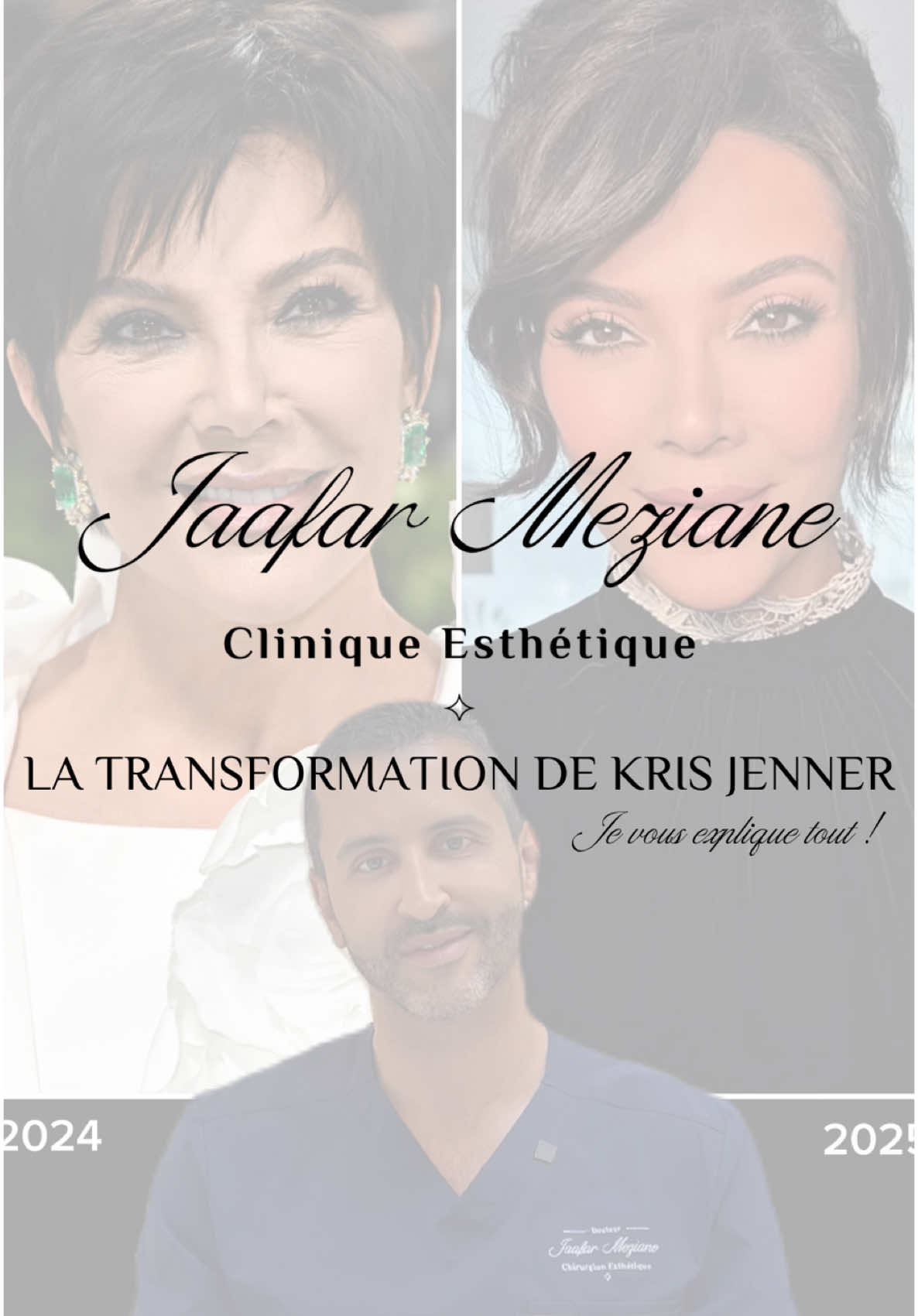 Kris Jenner : l’évolution d’une icône À 69 ans, Kris Jenner continue d’incarner le pouvoir, l’élégance et le changement. Surtout dernièrement 😱  Chirurgie esthétique, médecine esthétique ou skincare de pointe ✨ ? Je vous explique tout !  Et vous, que pensez-vous de la transformation de Kris Jenner ? #KrisJenner #Transformation #Esthetique #GlowUp #Kardashian #montpellier #jaafarmeziane #jaafarmezianecliniqueesthetique 