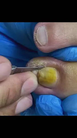nails #asmrvideo #satisfaction #asmrtiktoks #satysfing #nail #fyp #asmr #nailsalon #foryo #faryoupage #pageforyou #nails 