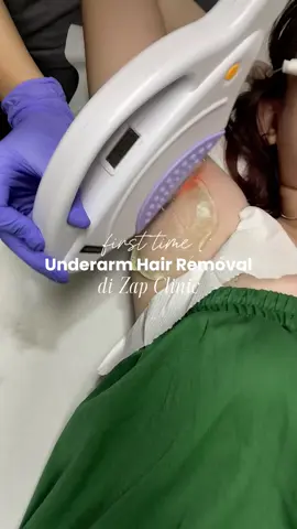 Seminggu sebelum treatment, wajib pakai sunscreen dan jangan cukur atau waxing ya! Dokternya juga saranin selama 2 hari untuk ngga olahraga, renang, apalagi yang bakal bikin kita keringatan berlebih, trs jgn scrub sama pakai deodoran, kecuali deodoran dari @ZAP Clinic 💚 #CapCut #IPL #underarm #hair #removal #laser #zap #RekomendasiZAP #review #jujur
