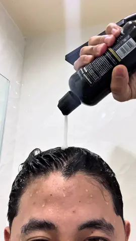 HALAAAAA MAY PAG ASA PA PALA TO! #minoxidil #hairgrowth #manipisnabuhok #haircare 