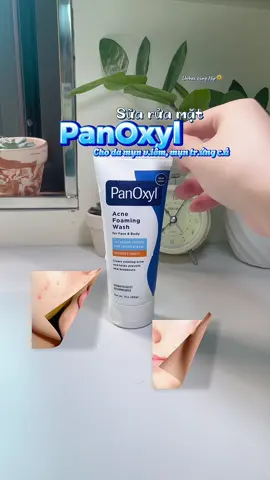 Sữa rửa mặt PanOxyl cho da mụ.n trứ.ng cá. Thương hiệu nổi tiếng của 🇺🇸 #unboxcunghip #panoxyl #panoxylacnewash #suaruamatdamun #suaruamatpanoxyl #saleluongve 