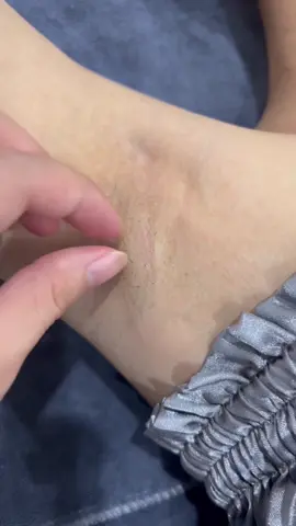 Rút 1 cái là phê liền 😍😍 #spa #trietlong #diodelaser #ipl #xuhuong #trending #priority #tulabbyskint 