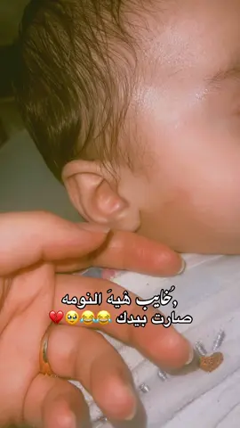 بنات أطفالكم مہَטּ يسننون شـِنو تسون وتستخدمون علاج ✨🌸🤍#الشعحب_الصيني_ماله_حل😂😂 #مالي_خلق_احط_هاشتاقات #ترند_تيك_توك #صعدو_الفيديو #اكسبلورر 