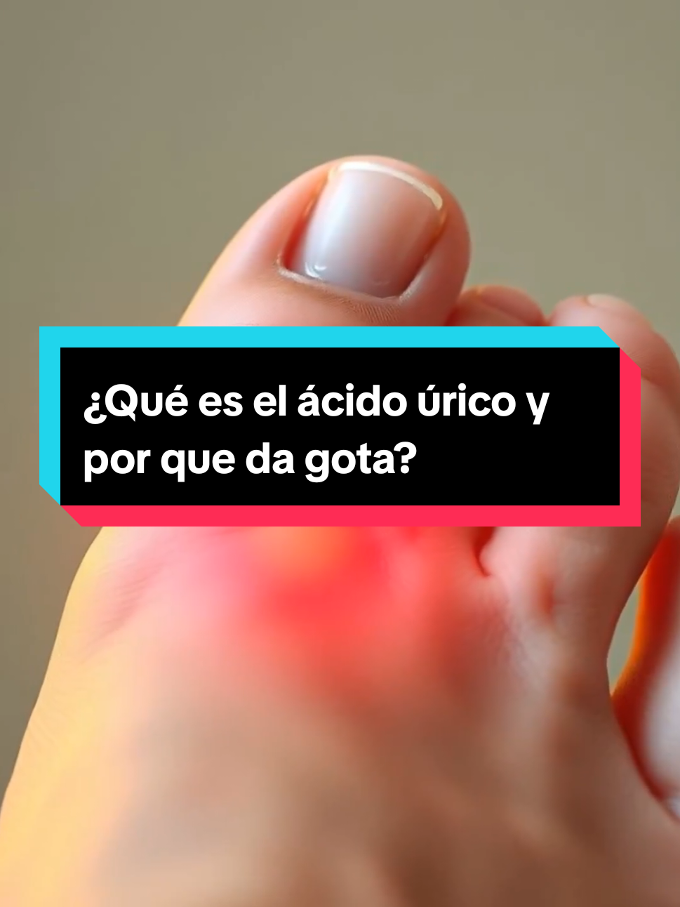 El ácido úrico puede generar un dolor intenso.  #acidourico #gota #cuerpohumano #salud #datointeresante #ciencia #dolorenelpie 