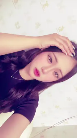 おでこ火傷したのーーーт т#08 #高2 