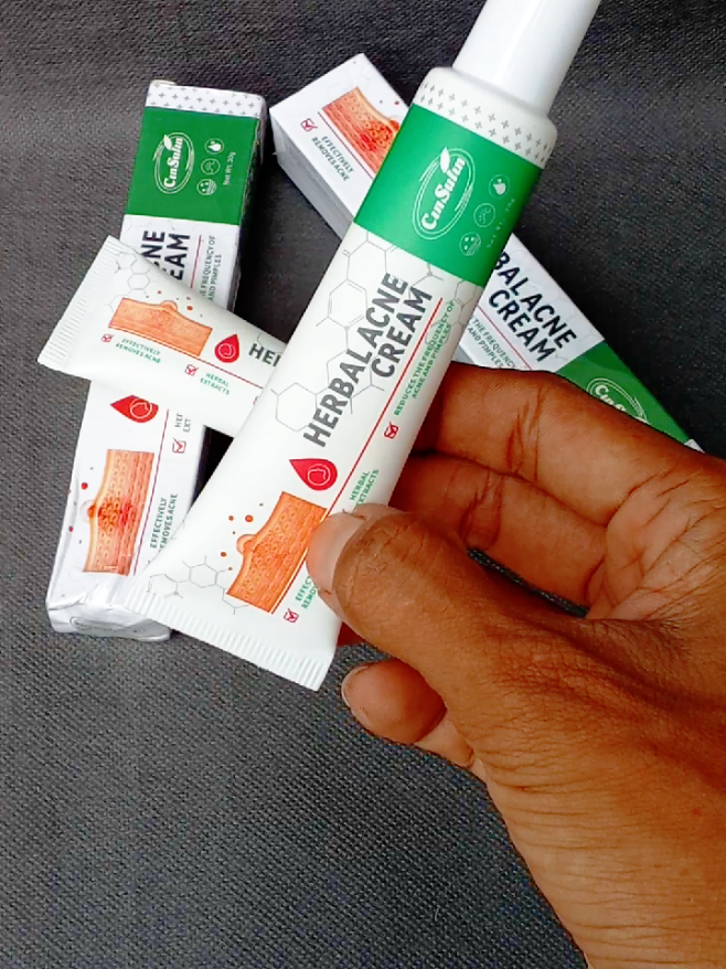 Obat jerawat Herbal Essence  #acne #acnetreatment #acneskin #cinsulin #gajiansale #viral #belilokal #gajiansale 