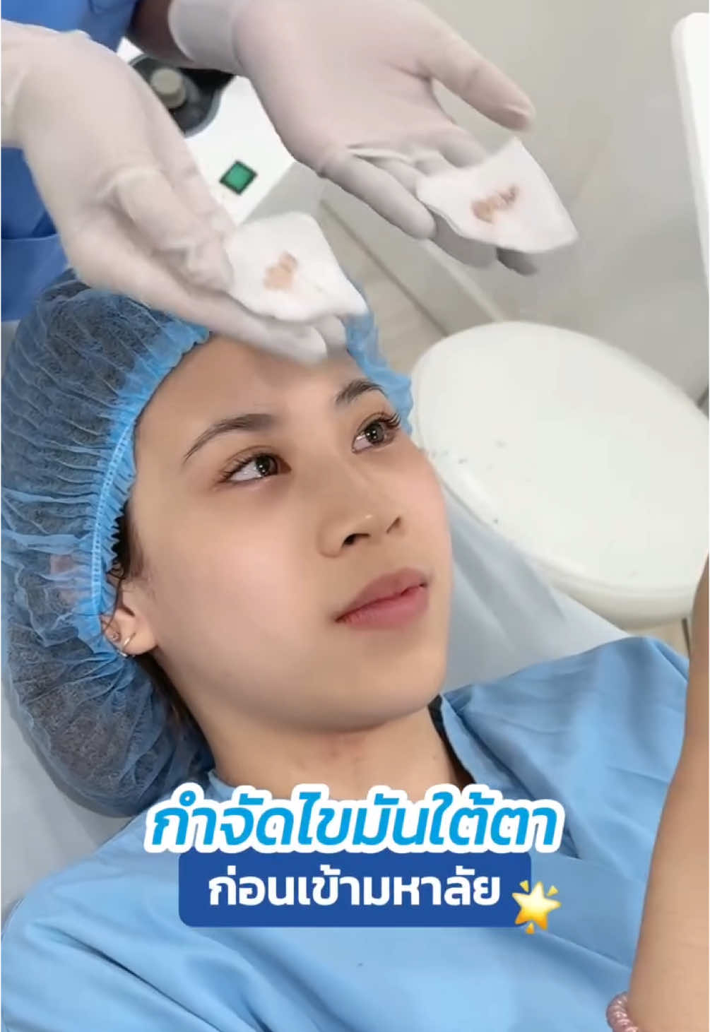 #กำจัดถุงใต้ตา ก่อนเข้ามหาลัย 🌟 #หมอสกาย #จักษุแพทย์ #skyclinic #babylock #กำจัดถุงใต้ตาแผลใน #ทำตาที่ไหนดี #สกายคลินิก #ตัดถุงใต้ตา #ศัลยกรรมตา 
