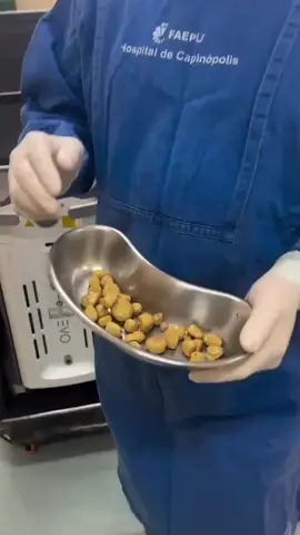 У Мужика из Мочевого Пузыря Достали Целый ПЛЯЖ