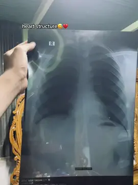 কিছু দিন...!😊❤️‍🩹 #fyp #tangail #foryoupage #4abid__lite #repost #frypシ゚viral #viralvideo #frypシ@TikTok Bangladesh @TikTok Trends @TikTok 