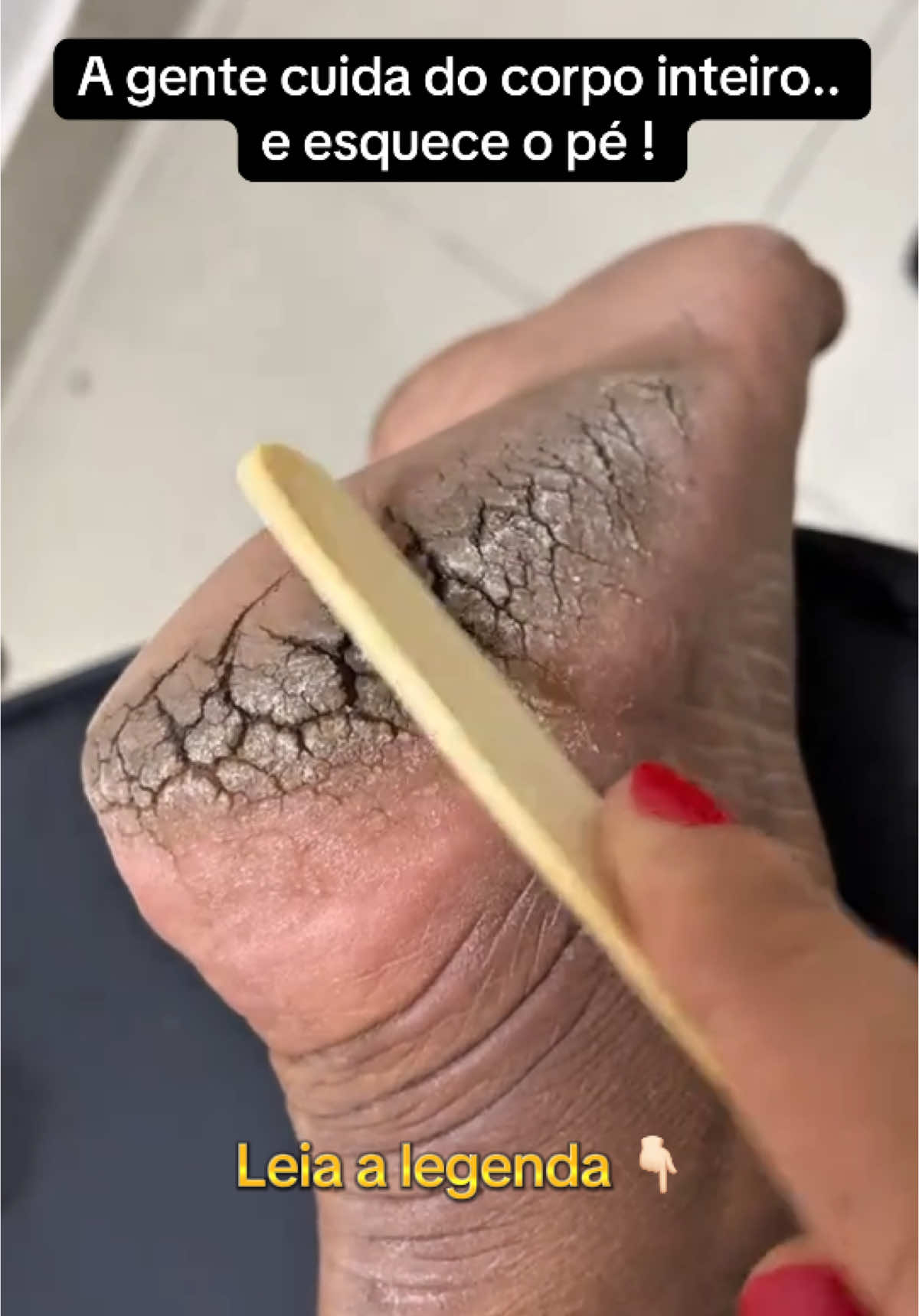 🦶 O calcanhar sofre todo dia. Mas recebe zero atenção. 💡 Cuidados mínimos já fazem a diferença: Hidratar após o banho. Usar meia ao dormir. Evitar chinelo direto no chão. Fazer escalda-pés. Usar esfoliante suave. Deixar o pé descansar. Amar seu corpo inteiro, inclusive o pé. 💬 Comenta se tem algum problema com teu pé ?👇🏻 #pe #PeRachado #PeCraquento #CalcanharRessecado #pé #AutocuidadoReal #mulher 