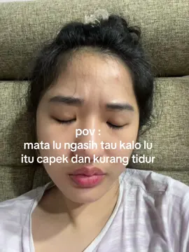 klo ga nambah lipetan mata ya kedutan matanye