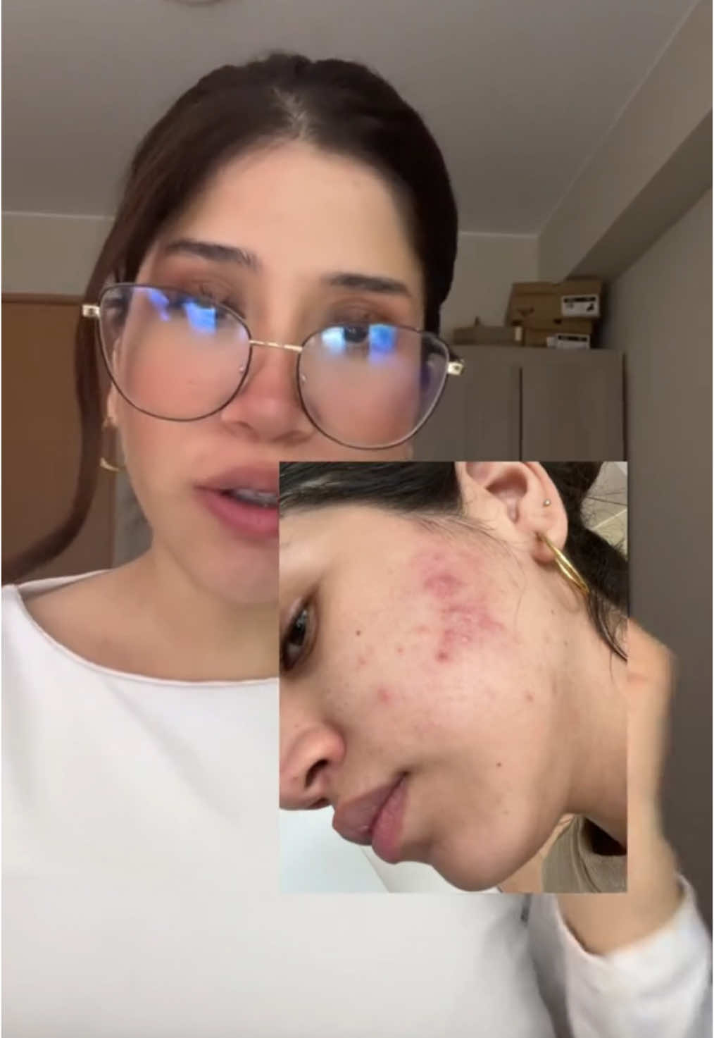 Lo que me ha ayudado todo este tiempo a mantener mi piel sin otro brote de acné ha sido tener una buena rutina, no tiene que ser súper costosa y con un montón de productos, lo importante es que sean buenos ⭐️ @bepanthenpe    #BepanthenDerma #acne #SkinCare #piel #EligeAmarte 