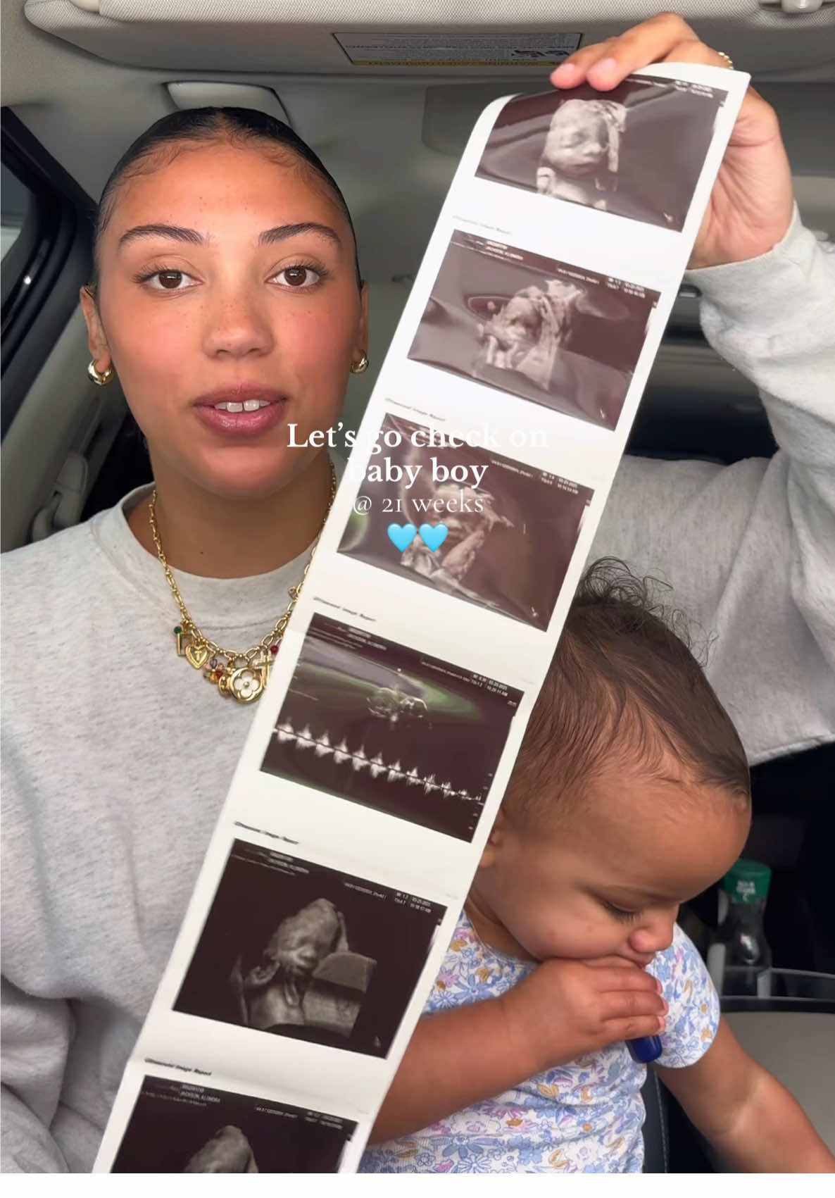 I can’t believe how much he’s grown🥹 #momcontent #pregnant #pregnancytiktok #ultrasound #momof3 #momtok #fyp 