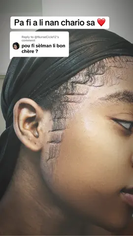 Replying to @@NurseCicie12 sa e pa fi a ni pou fi ni pou gason #goviral #minoxidilresult #creatorsearchinsights #govoralontiktok #fypシ #wendyyy 