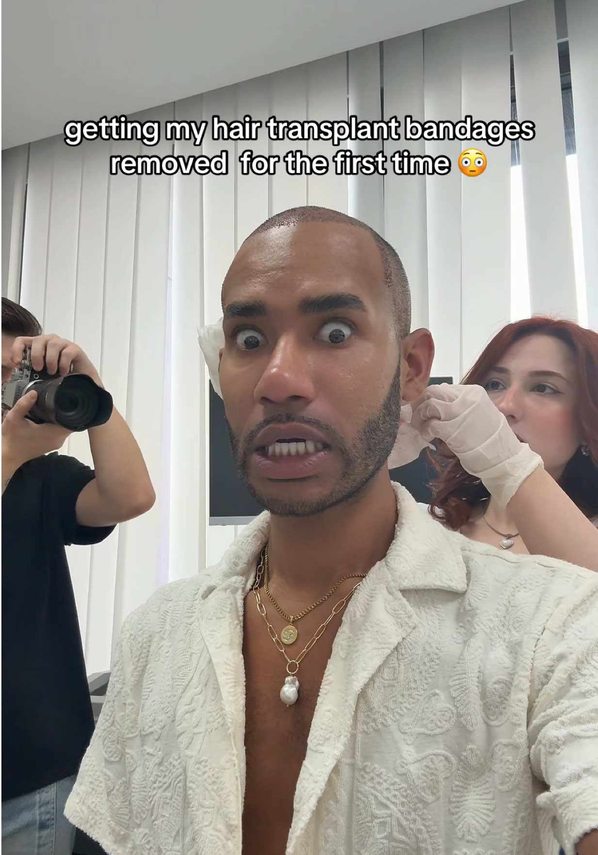 Trigger warning pt. 2‼️ Bandage removal ⚠️  #day2 #bandageremoval #hairtransplant #postop #turkey🇹🇷 #infamousxdrew #fyp 