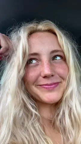 Sun=freckles ☀️☀️☀️#california #surftok #Summer #freckles #fyp #relatable 