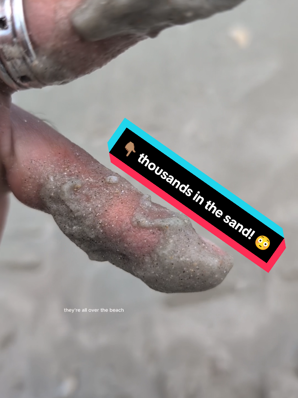This is why I wear shoes on the beach! 😳 #beach #beachvibes #beachday #heydudeshoes #heydude #tiktokshopcreatorpicks 