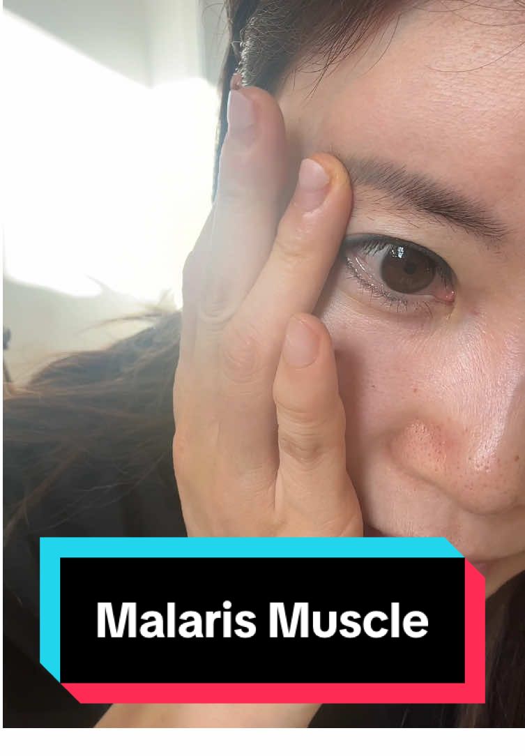 Did you know the malaris muscle is often more developed in Asian faces? It’s tiny—but powerful for lifting the eye, brow, and cheek. #KokoFaceYoga #FaceYoga #FaceAnatomy #MalarisMuscle #FacialStructure #BeautyScience #FaceYogaExpert #ZygomaticusMajor