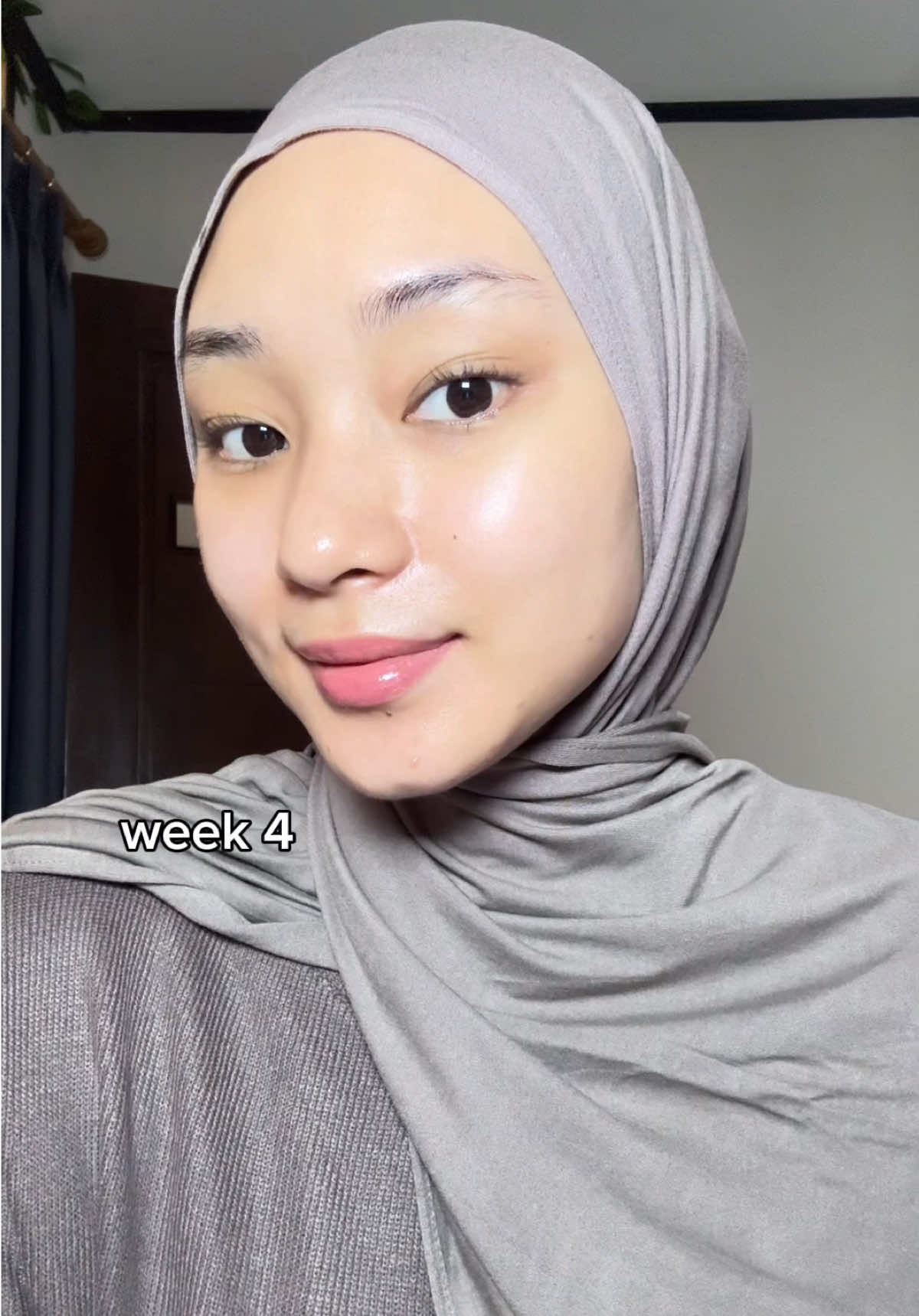 kuncinya harus sabar dan pake serum moist dari g2g ini 🫵🏻🫰🏻😚 #moisturizerviral #serumviral #darkspotset 