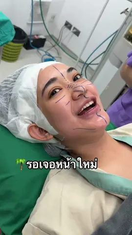 รอเจอหน้าใหม่นุ้ยได้เลย👃🏻🌴 #เสริมจมูก #จมูก #จมูก #มาแรงในtiktok #ดมยาสลบโดยวิสัญญีแพทย์ #ดมยาสลบ #ดันขึ้นฟีดที #สาวใต้ตาคม #สาวใต้ #สาวใต้ตาคมผมยาว #คนใต้ #ภาคใต้ #สงขลา #ดาวติ๊กต๊อก #ดาวtiktok #มาแรงในtiktok 
