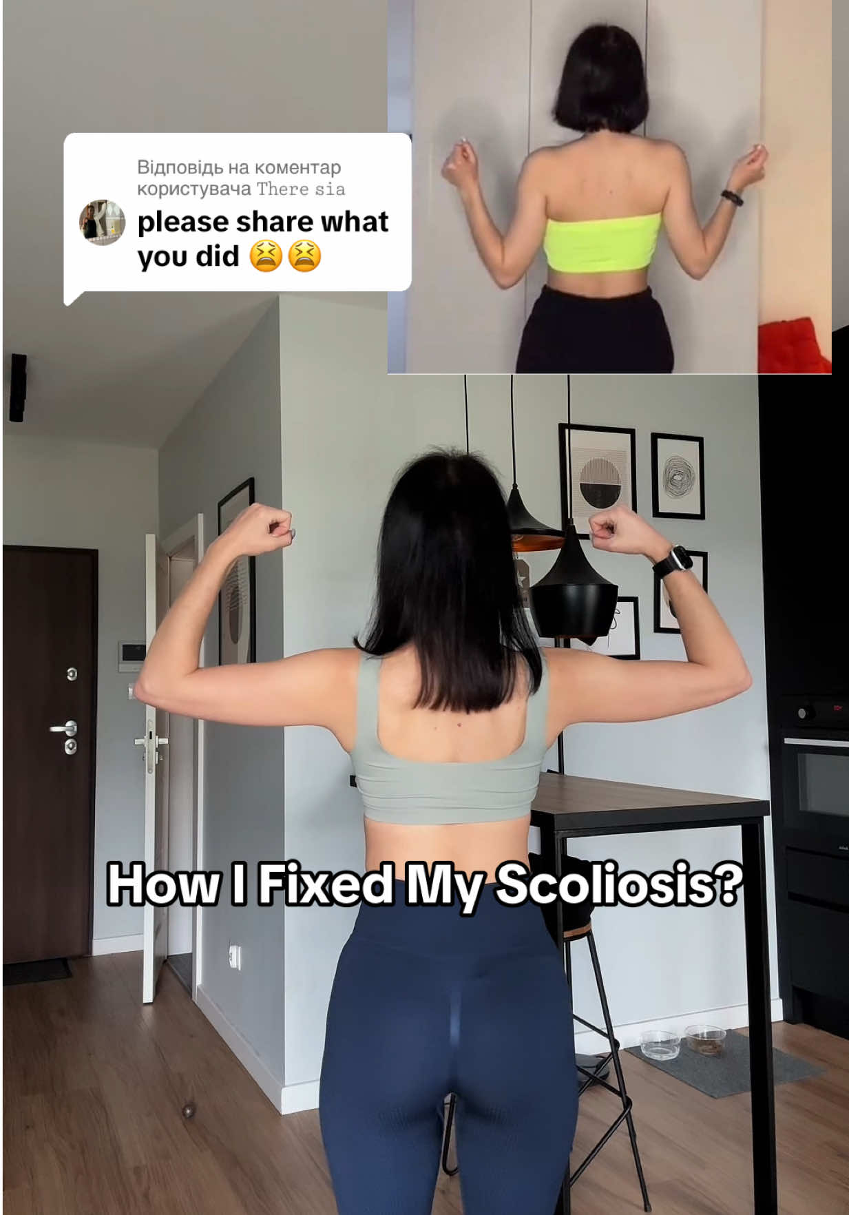 Відповідь користувачу @𝚃𝚑𝚎𝚛𝚎 𝚜𝚒𝚊 Stability, posture, and consistency — it’s possible! #scoliosisjourney #posturefix #spinehealth #TikTokFitness #backpainrelief #beforeandafter #healingmybody 