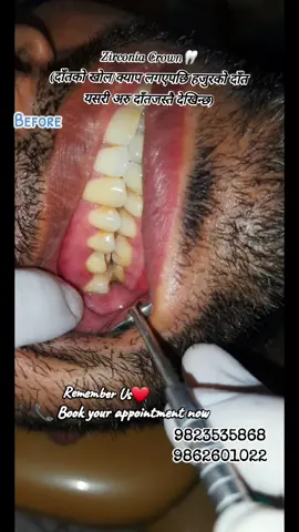 Remember Us❤️ Free OPD and Consultation Every Friday🙏@Dr.Rabin Paudyal @Dr.Prajina Kafle #janasewadentalitahari #dentalawareness #zirconia #itaharimuser #itahari #fyp #dentalclinicinitahari #viral #sunsari #dentalclinic #nepalitiktok #dentistry #fyppppppppppppppppppppppp 