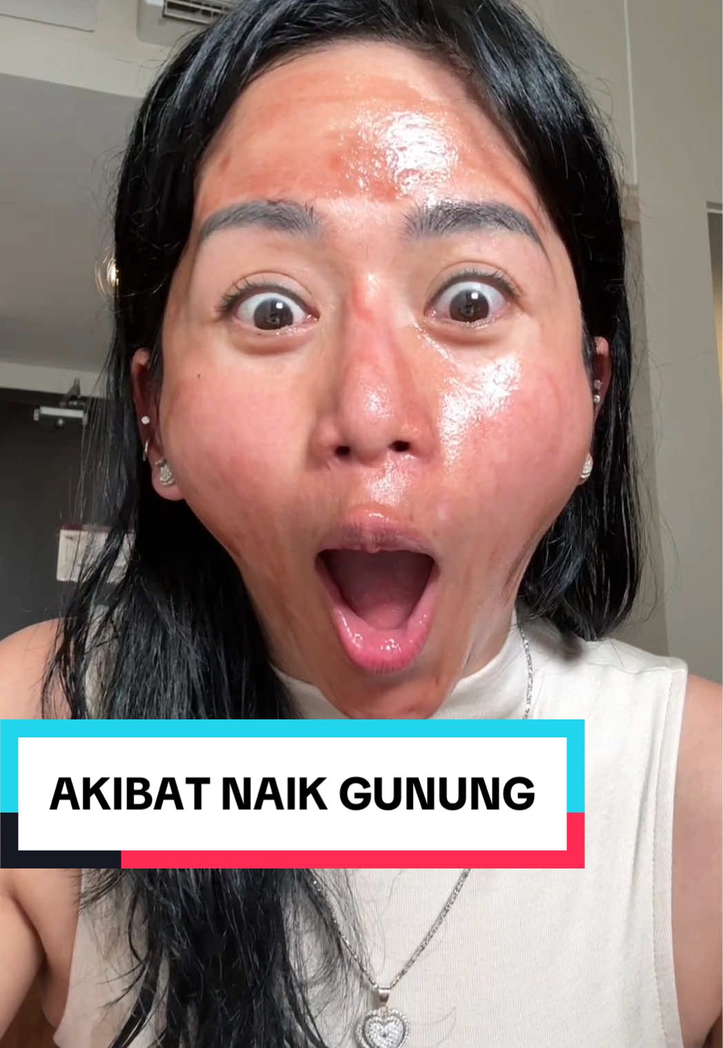 Ide buat kalian juga kalau kulit wajahnya lagi break out pake Intensive Peeling Solution aja, auto glowing dan cerah seketika #awurawuremplok #faridanurhan 