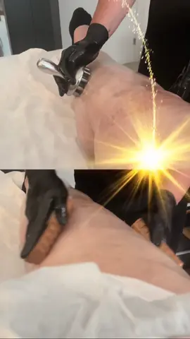#CapCut mujer que viene desesperada con las piernas duras y con mucho dolor . Nos cuenta que ya está sin dolor !!!