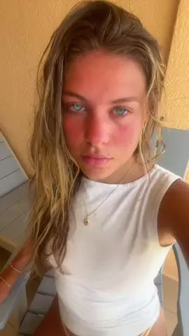 Need blue contacts now