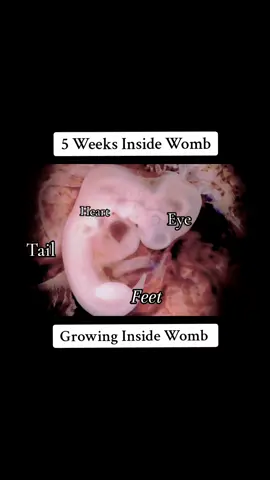 5 weeks baby growing inside the Womb #5weekspostop #5weeksold #5weekspregnant #5weeks #5weekspfeto #babyinsidewomb #babyinsidebelly #viralvideo #viraltiktok 