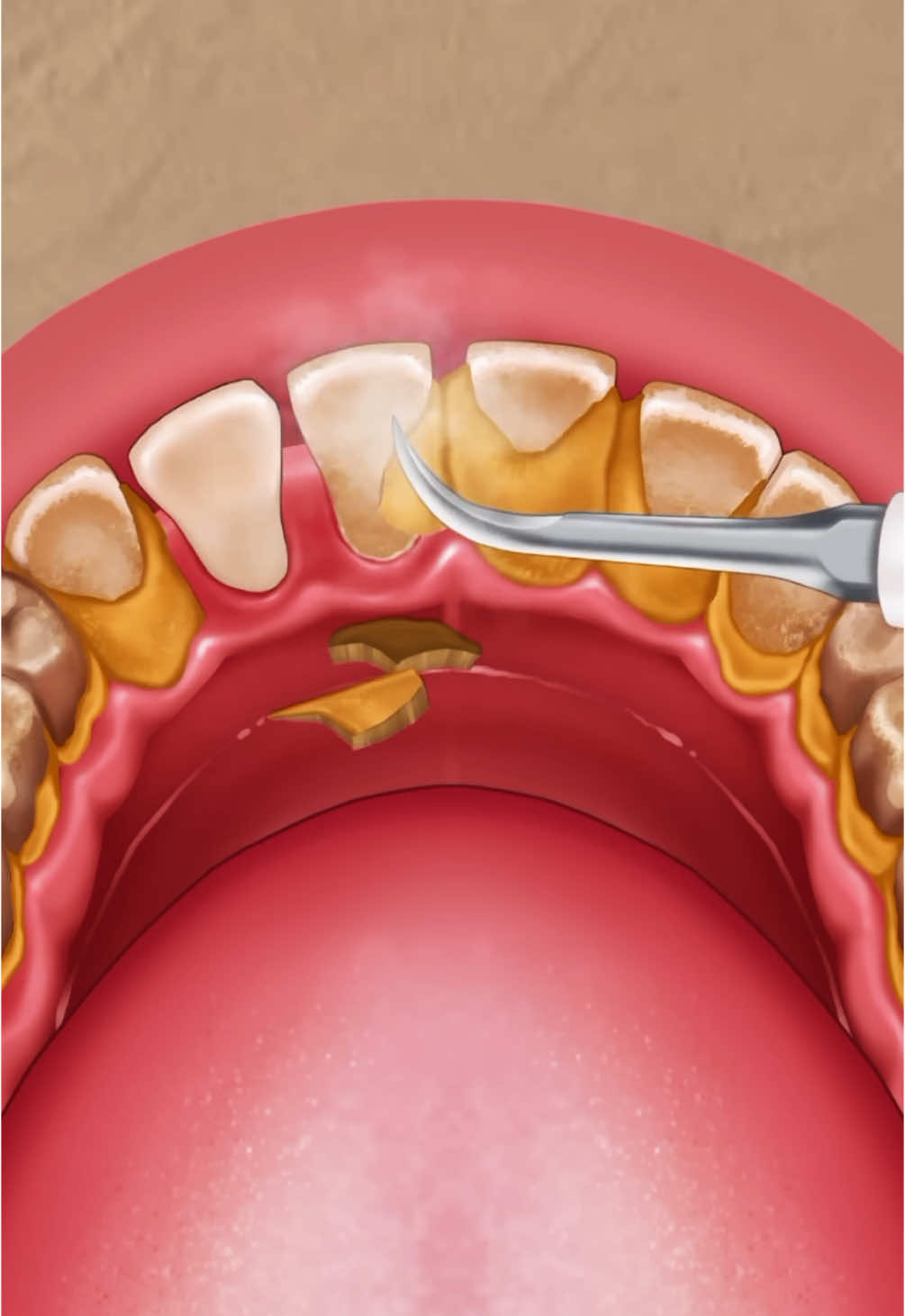 #asmr #teeth #teethwhitening #teethcare 