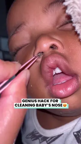 Is this a good way to clean your baba's bogeys? 😅 @micaelamiranda_ via BViral #nosecleaning #nose #cleaning #bogey #booger #snot #tweezers #baby #babycare #MomsofTikTok #momtok #momlife